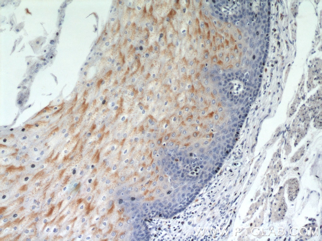 Immunohistochemistry (IHC) staining of human oesophagus tissue using GUF1 Polyclonal antibody (17489-1-AP)