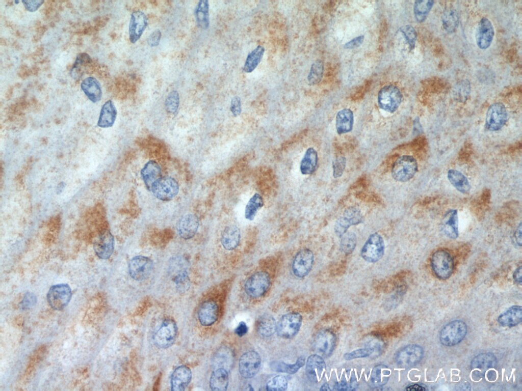 IHC staining of human oesophagus using 17489-1-AP