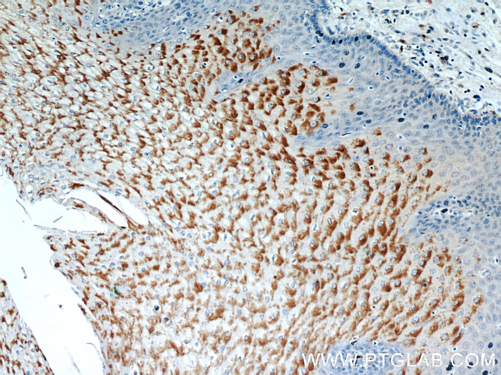 Immunohistochemistry (IHC) staining of human oesophagus tissue using GUF1 Polyclonal antibody (17489-1-AP)