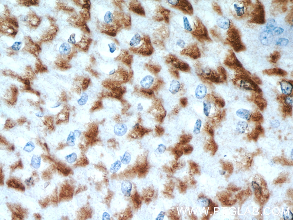 IHC staining of human oesophagus using 17489-1-AP