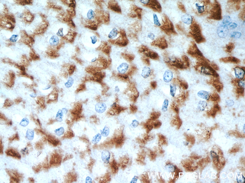 Immunohistochemistry (IHC) staining of human oesophagus tissue using GUF1 Polyclonal antibody (17489-1-AP)