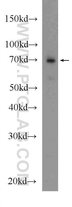 Western Blot (WB) analysis of HeLa cells using GUF1 Polyclonal antibody (17489-1-AP)