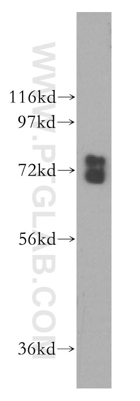 Western Blot (WB) analysis of HepG2 cells using GUF1 Polyclonal antibody (17489-1-AP)