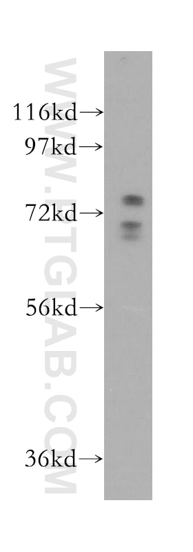 Western Blot (WB) analysis of mouse pancreas tissue using GUF1 Polyclonal antibody (17489-1-AP)