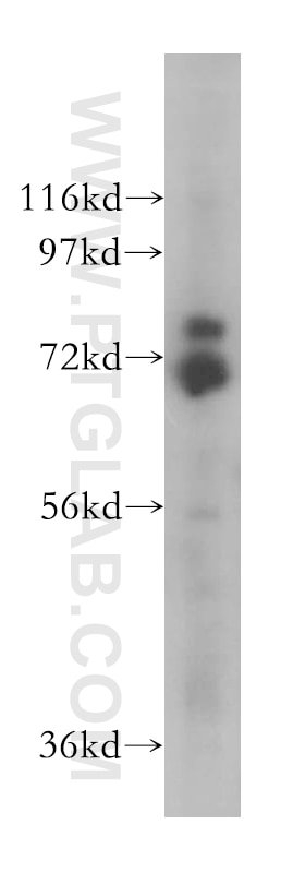 WB analysis of mouse brain using 17489-1-AP