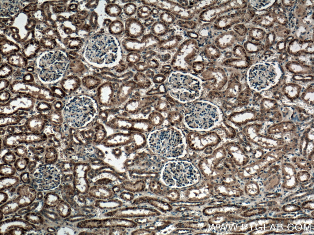 Immunohistochemistry (IHC) staining of human kidney tissue using GUK1 Polyclonal antibody (10755-1-AP)