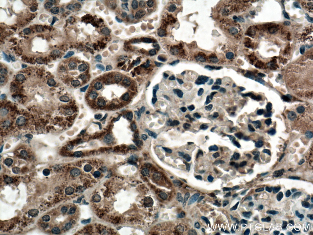 IHC staining of human kidney using 10755-1-AP
