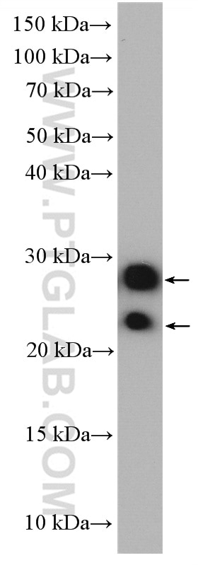 Western Blot (WB) analysis of HEK-293 cells using GUK1 Polyclonal antibody (10755-1-AP)
