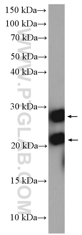Western Blot (WB) analysis of HeLa cells using GUK1 Polyclonal antibody (10755-1-AP)