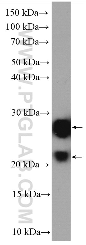 Western Blot (WB) analysis of HEK-293 cells using GUK1 Polyclonal antibody (10755-1-AP)