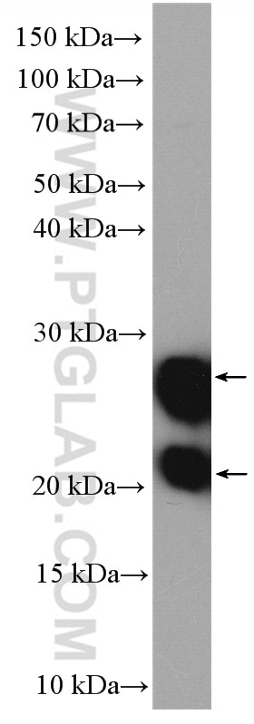 Western Blot (WB) analysis of HeLa cells using GUK1 Polyclonal antibody (10755-1-AP)