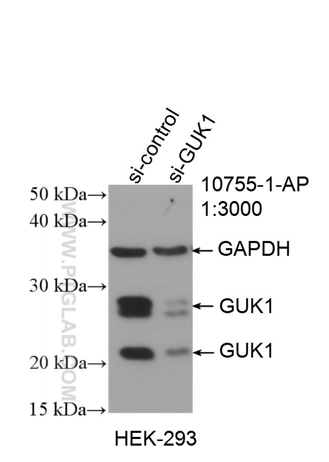 Western Blot (WB) analysis of HEK-293 cells using GUK1 Polyclonal antibody (10755-1-AP)