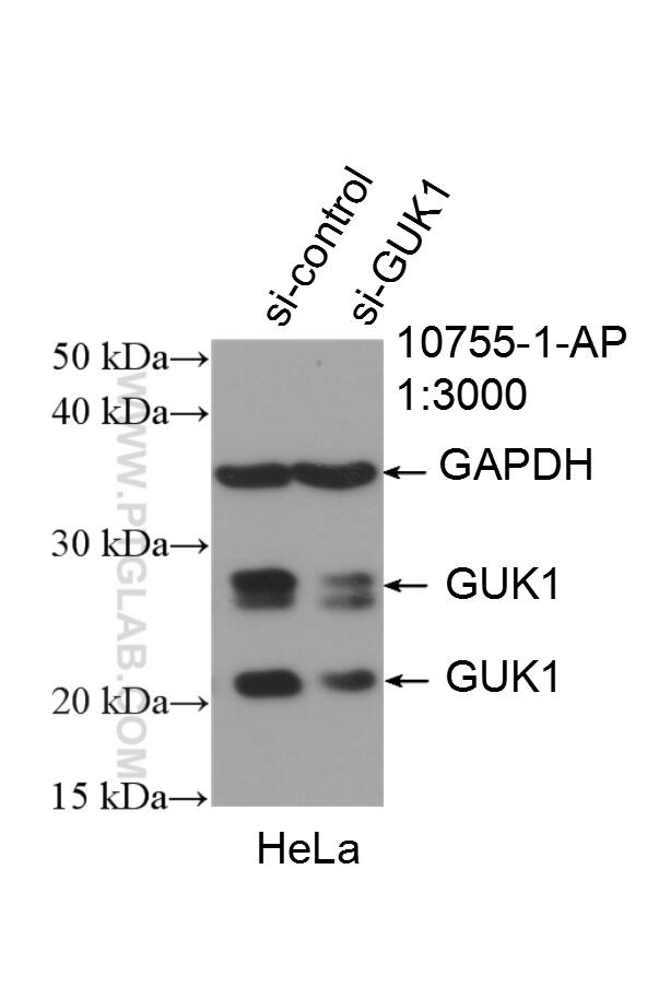 Western Blot (WB) analysis of HeLa cells using GUK1 Polyclonal antibody (10755-1-AP)