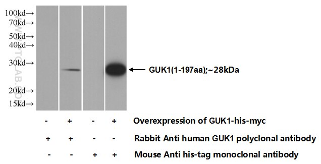 GUK1