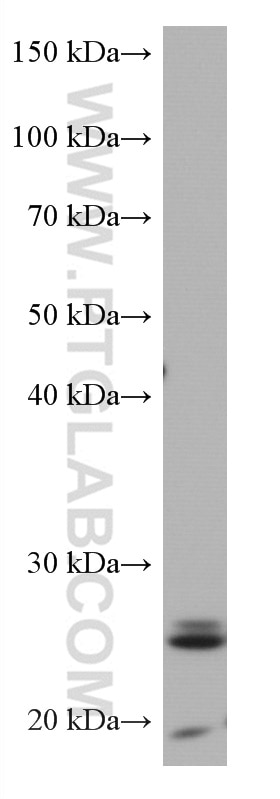 Western Blot (WB) analysis of HEK-293 cells using GUK1 Monoclonal antibody (67047-1-Ig)