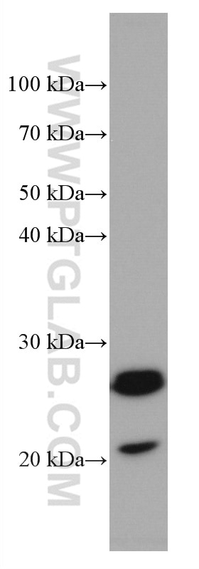 Western Blot (WB) analysis of Jurkat cells using GUK1 Monoclonal antibody (67047-1-Ig)