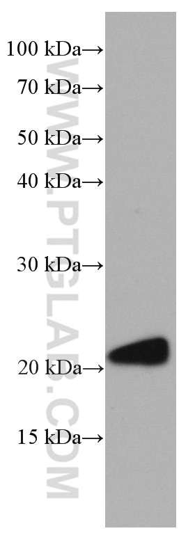 Western Blot (WB) analysis of fetal human brain tissue using GUK1 Monoclonal antibody (67047-1-Ig)