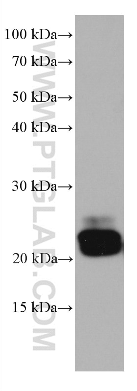 Western Blot (WB) analysis of rat brain tissue using GUK1 Monoclonal antibody (67047-1-Ig)