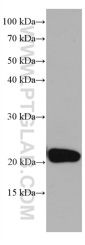 Western Blot (WB) analysis of mouse brain tissue using GUK1 Monoclonal antibody (67047-1-Ig)