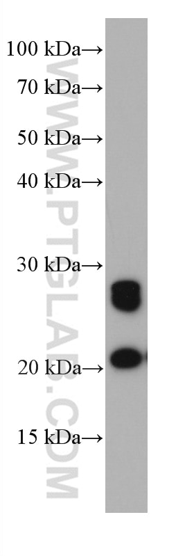 Western Blot (WB) analysis of Jurkat cells using GUK1 Monoclonal antibody (67047-1-Ig)