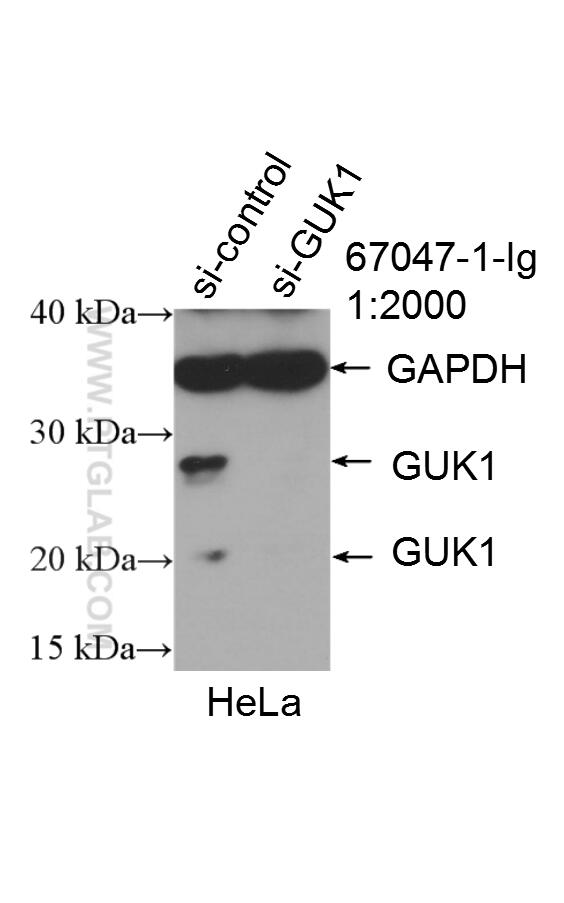 WB analysis of HeLa using 67047-1-Ig