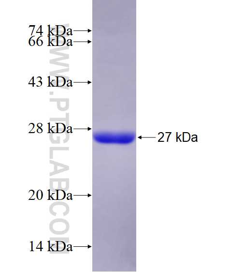 GUK1 fusion protein Ag28805 SDS-PAGE