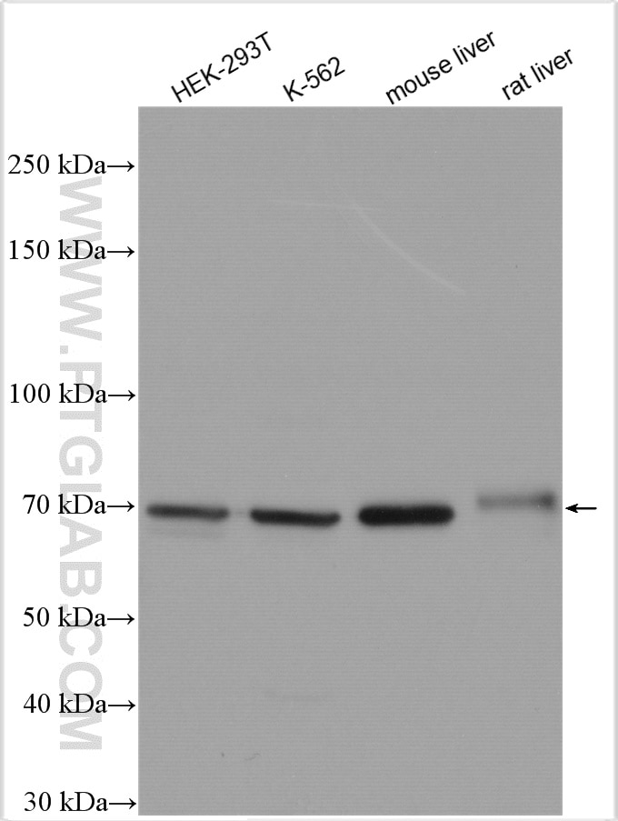Western Blot (WB) analysis of various lysates using GUSB Polyclonal antibody (16332-1-AP)