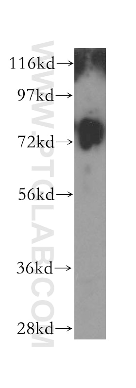 Western Blot (WB) analysis of HL-60 cells using GUSB Polyclonal antibody (16332-1-AP)