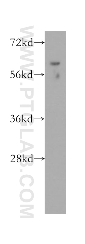 Western Blot (WB) analysis of mouse heart tissue using GUSB Polyclonal antibody (16332-1-AP)