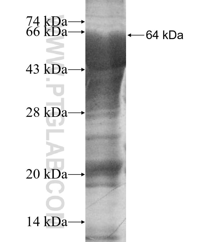 GUSB fusion protein Ag9453 SDS-PAGE