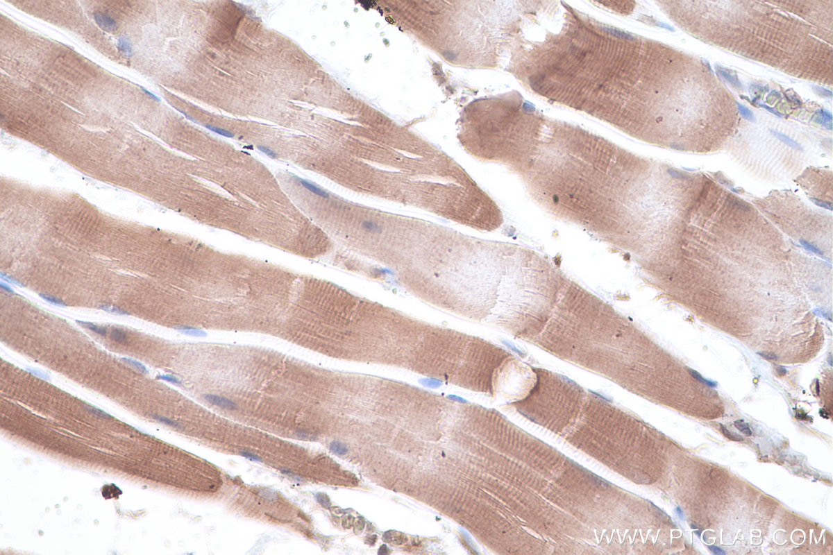 Immunohistochemistry (IHC) staining of rat skeletal muscle tissue using GYG1 Polyclonal antibody (12836-1-AP)