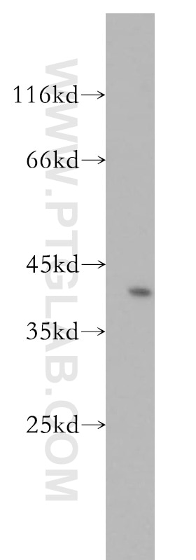 WB analysis of human testis using 12836-1-AP