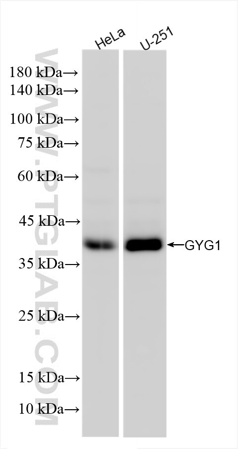 Western Blot (WB) analysis of various lysates using GYG1 Recombinant antibody (86056-1-RR)