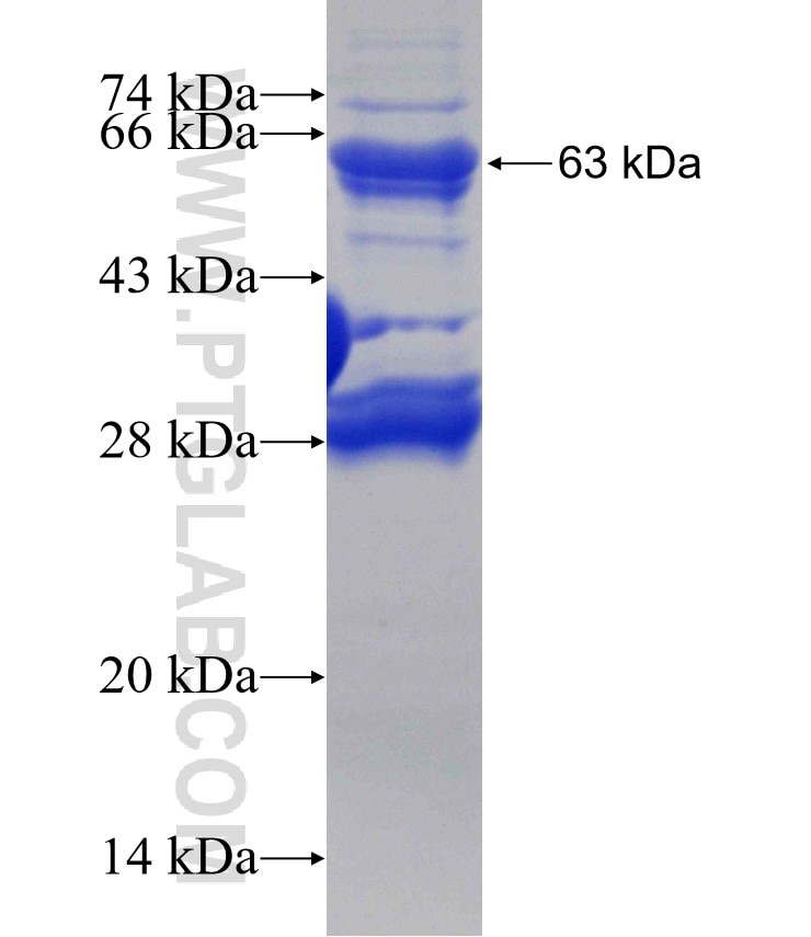GYG1 fusion protein Ag3583 SDS-PAGE