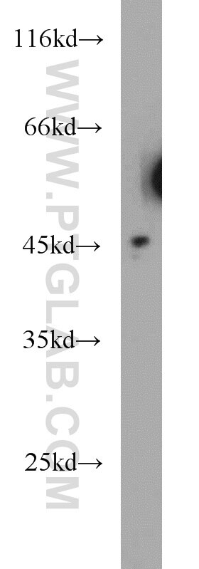 GYG2