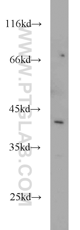 Western Blot (WB) analysis of human liver tissue using GYG2 Polyclonal antibody (13150-1-AP)