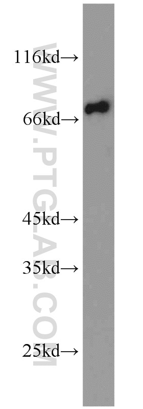 Western Blot (WB) analysis of HEK-293 cells using GYG2 Polyclonal antibody (13150-1-AP)
