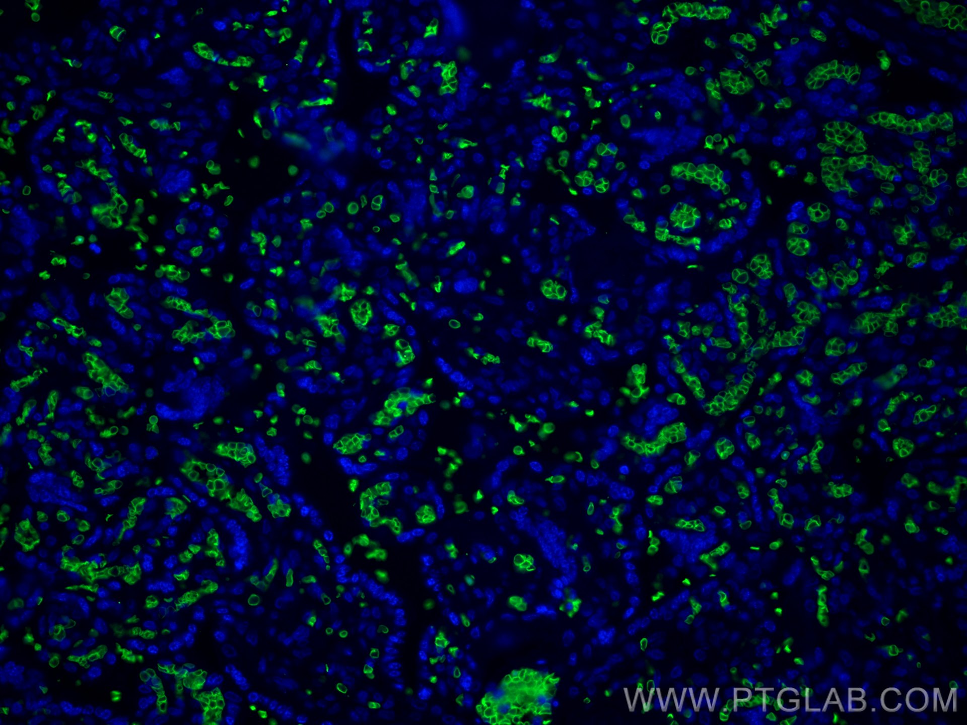 Immunofluorescence (IF) / fluorescent staining of human placenta tissue using human Glycophorin A Polyclonal antibody (15874-1-AP)