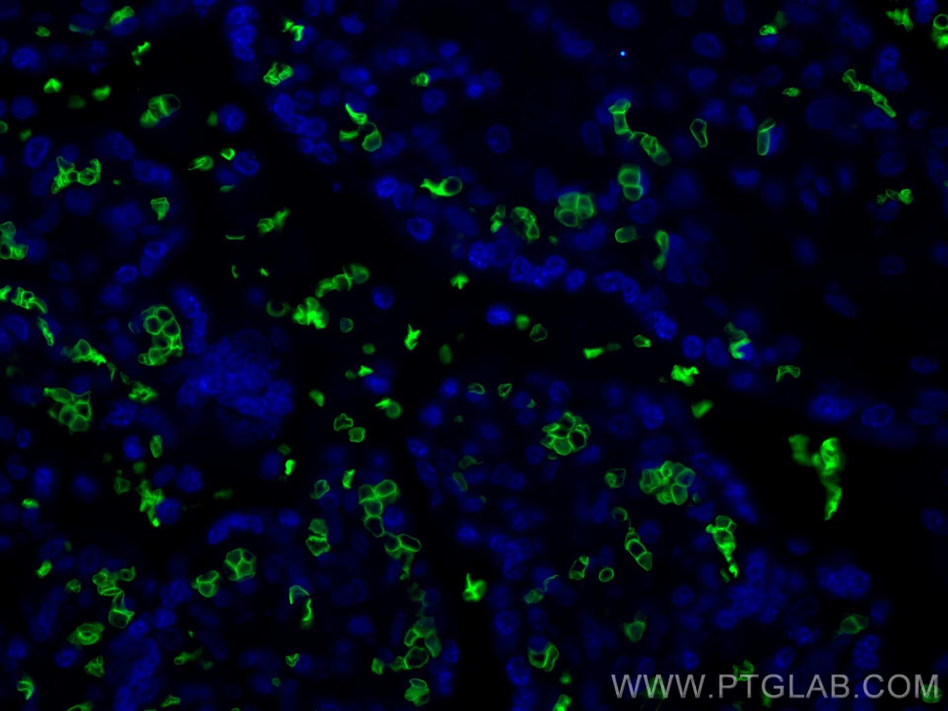 Immunofluorescence (IF) / fluorescent staining of human placenta tissue using Glycophorin A Polyclonal antibody (15874-1-AP)