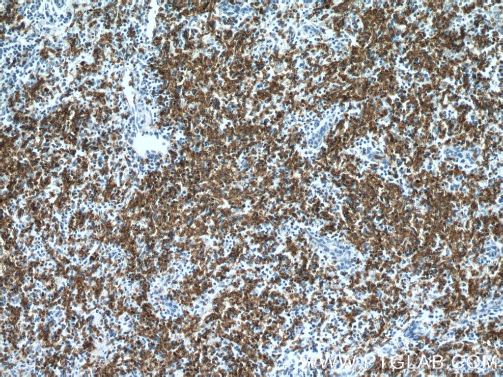 Immunohistochemistry (IHC) staining of human spleen tissue using Glycophorin A Polyclonal antibody (15874-1-AP)