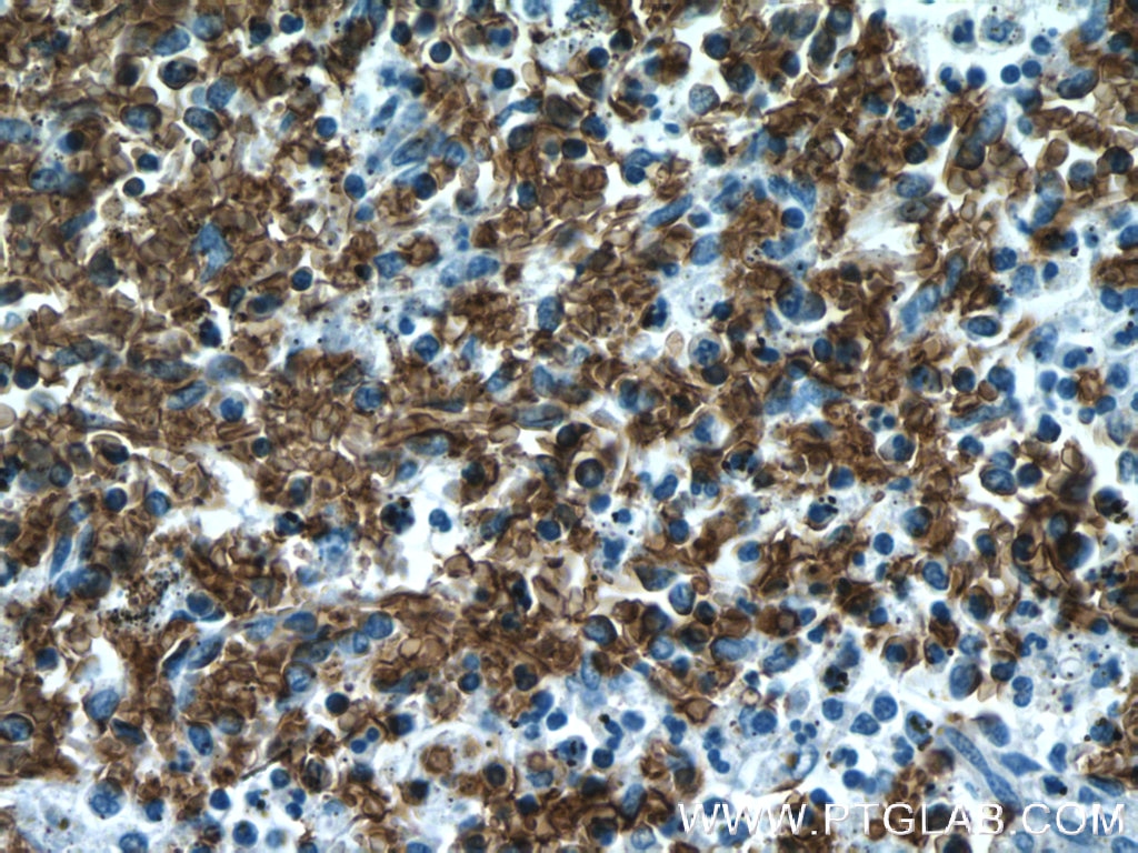 Immunohistochemistry (IHC) staining of human spleen tissue using human Glycophorin A Polyclonal antibody (15874-1-AP)