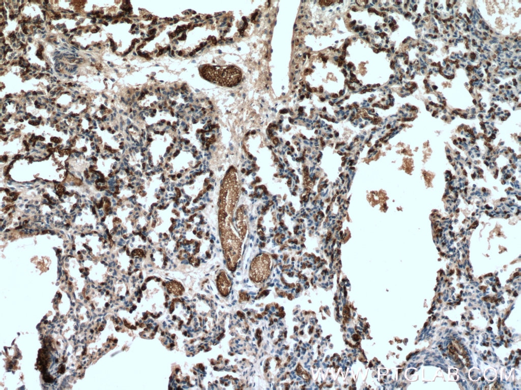 Immunohistochemistry (IHC) staining of human lung tissue using Glycophorin A Polyclonal antibody (15874-1-AP)