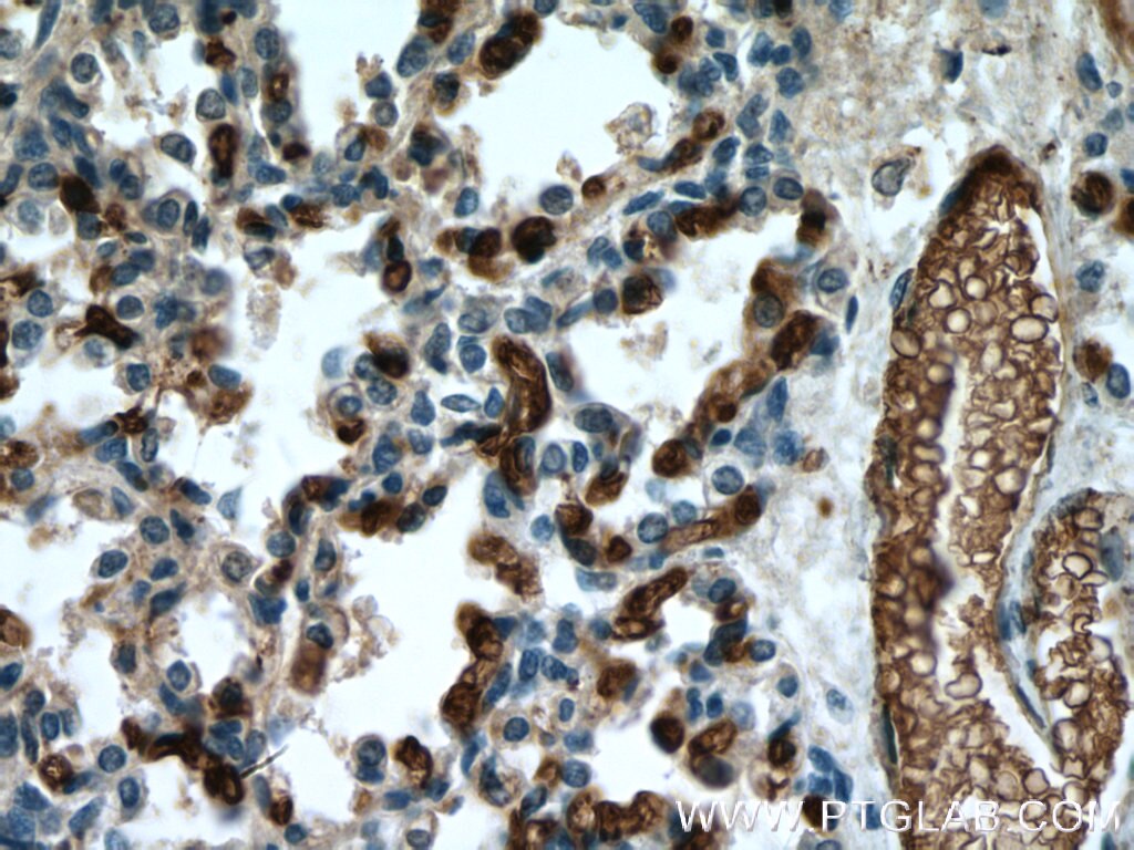 Immunohistochemistry (IHC) staining of human lung tissue using Glycophorin A Polyclonal antibody (15874-1-AP)