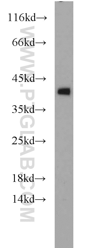 Western Blot (WB) analysis of K-562 cells using Glycophorin A Polyclonal antibody (15874-1-AP)