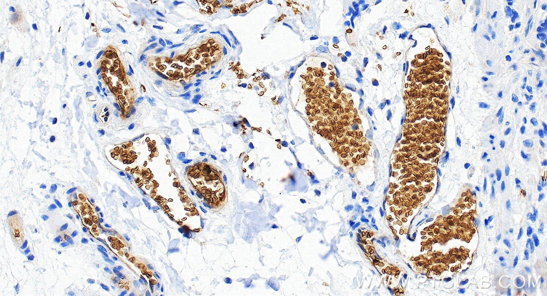 Immunohistochemical analysis of paraffin-embedded human colon tissue slide using 85182-3-RR (Glycophorin A/CD235a antibody) at dilution of 1:2000 (under 20x lens). Heat mediated antigen retrieval with Tris-EDTA buffer (pH 9.0). This data was developed using the same antibody clone with 85182-3-PBS in a different storage buffer formulation. Immunohistochemistry (IHC) staining of human colon tissue using Glycophorin A/CD235a Recombinant monoclonal antibo (85182-3-RR)