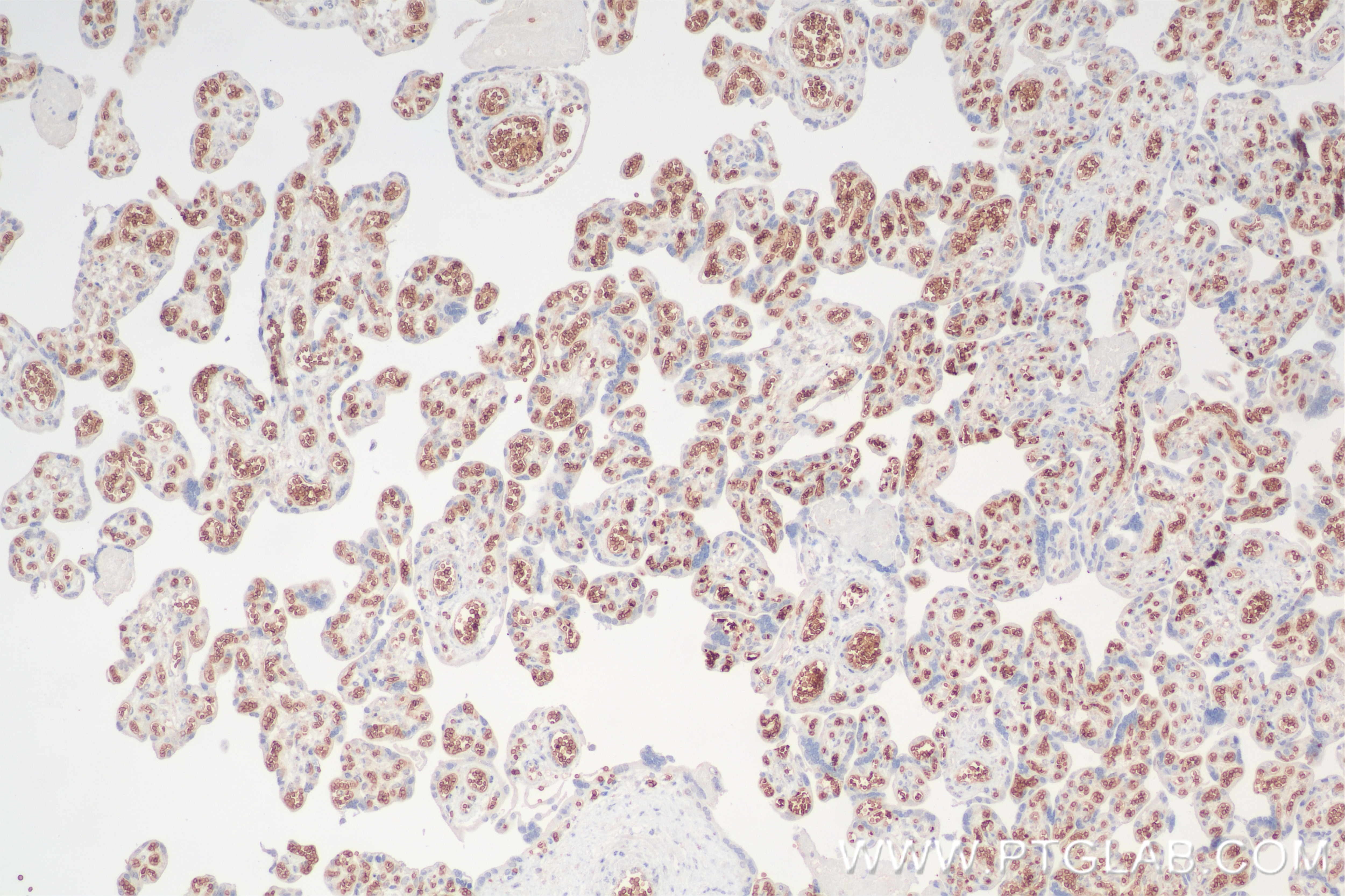 Immunohistochemistry (IHC) staining of human placenta tissue using Glycophorin A/CD235a Recombinant antibody (85182-3-RR)