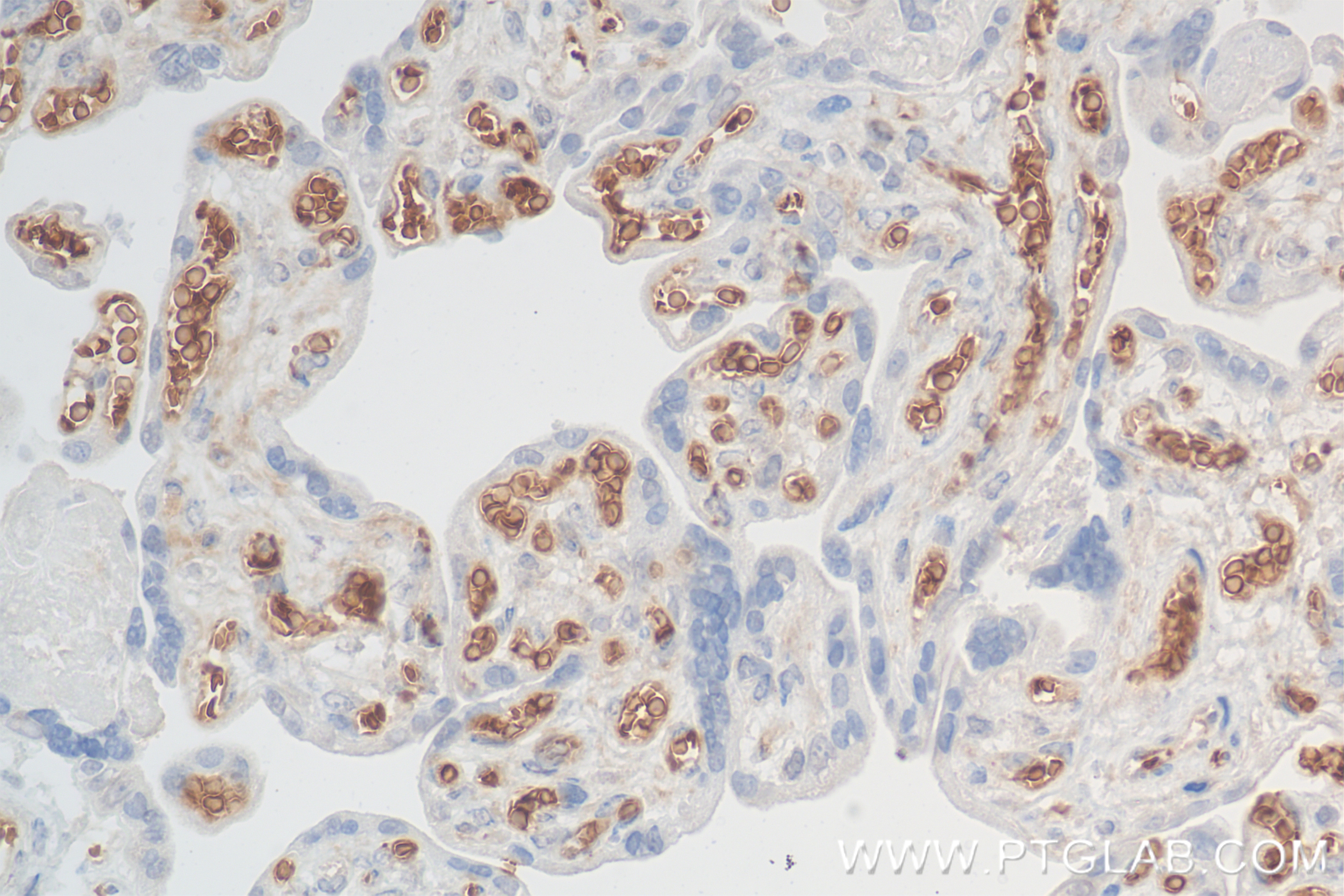 Immunohistochemistry (IHC) staining of human placenta tissue using Glycophorin A/CD235a Recombinant antibody (85182-3-RR)