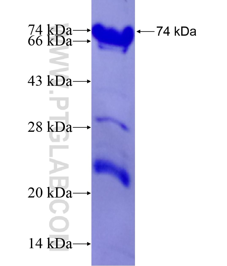 GYPA fusion protein Ag8635 SDS-PAGE