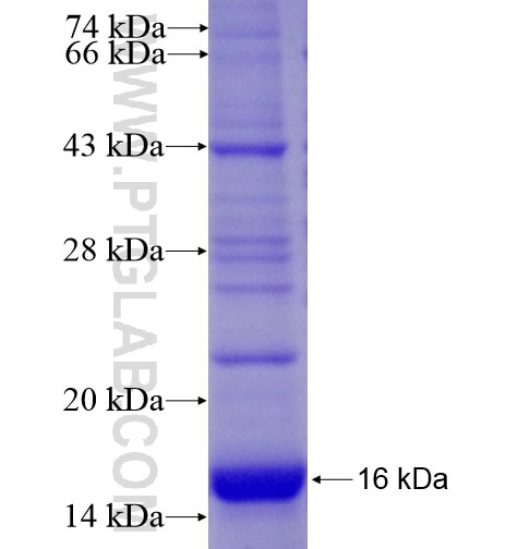 GYPB fusion protein Ag12919 SDS-PAGE