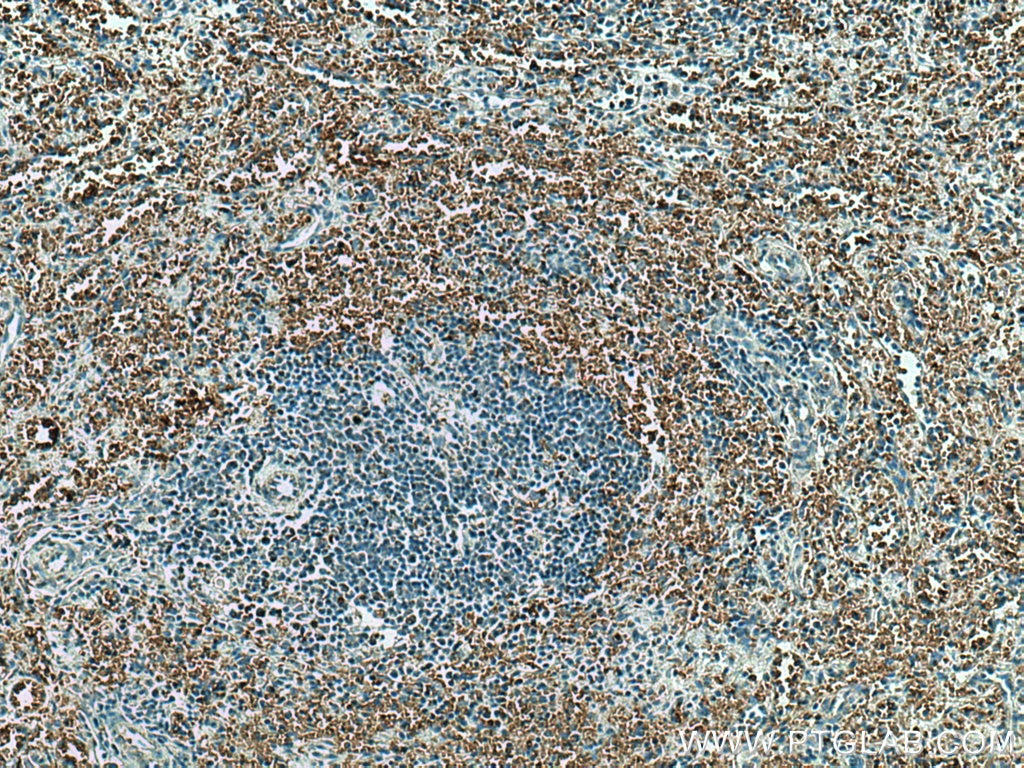 IHC staining of human spleen using 18147-1-AP